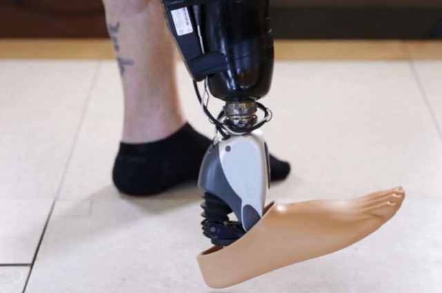 ossur prosthetics