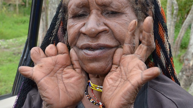 Batı Yeni Gine'deki Dani insanlarının garip bir adeti vardır. Ölen birinin ardından üzüldüklerinde parmaklarından bir boğumu da feda ederler.